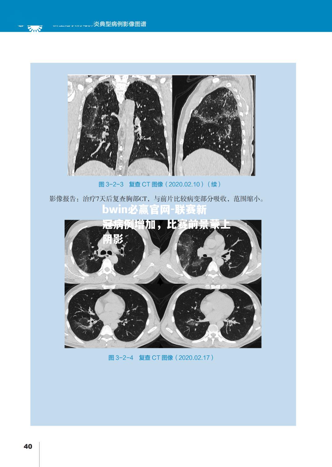 联赛新冠病例增加，比赛前景蒙上阴影